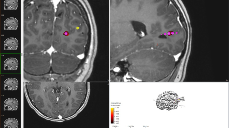 Utterly shameless diagnostic brain imaging neurobollocks