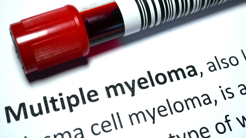 New cellular therapy offers hope for multiple myeloma patients ...