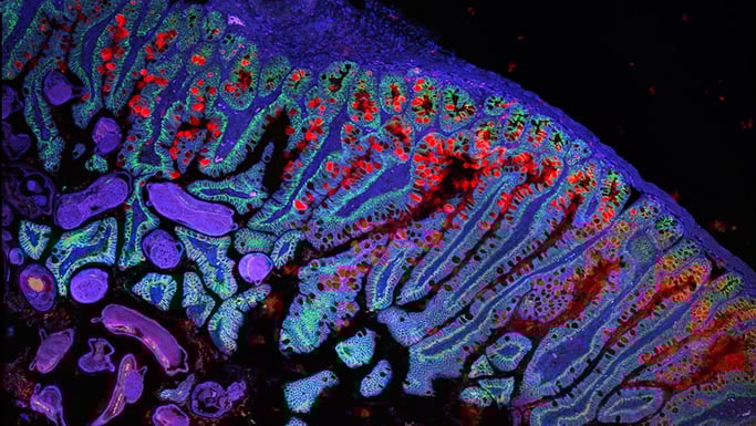 Gut epithelium