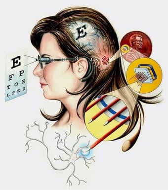 visual prosthesis