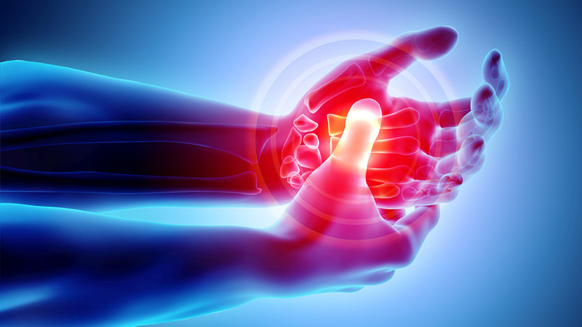 What Are The Signs Of Arthritis In The Hands Uchicago Medicine