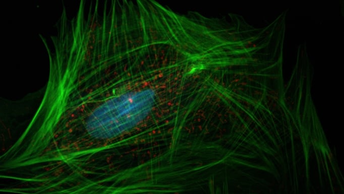 Microscopic image of a fibroblast (top) showing the nucleus (blue), mitochondria (red), and actin cytoskeleton (green). Source: NIH - National Human Genome Research Institute.
