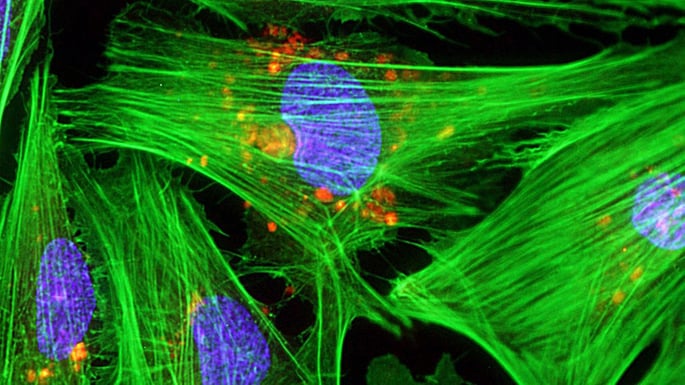 Heart muscle cells