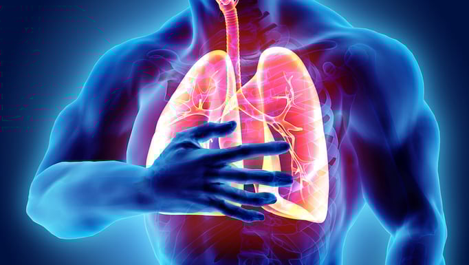 Pulmonary embolism