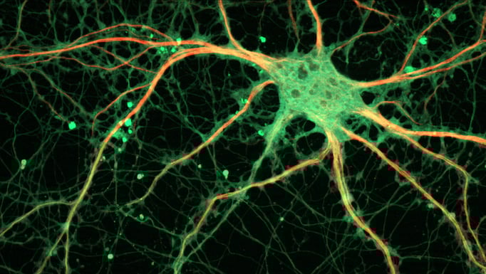 Cultured rat neuron