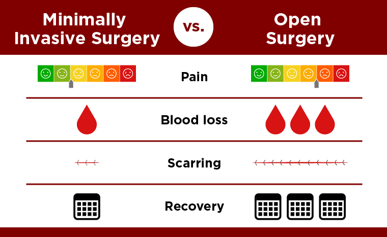 A minimally invasive surgical approach for the treatment of