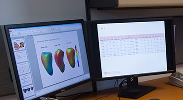 What Does A Cardiac CT Scan Show or Detect and When Do You Need It? -  UChicago Medicine