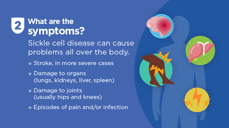 sickle cell symptoms and complications