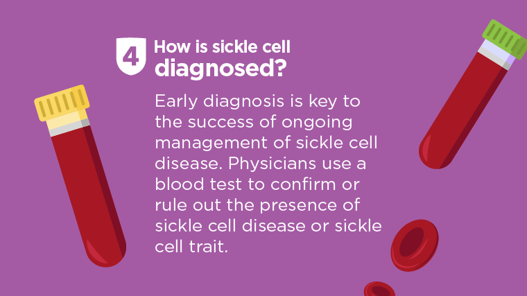 How To Diagnose Sickle Cell