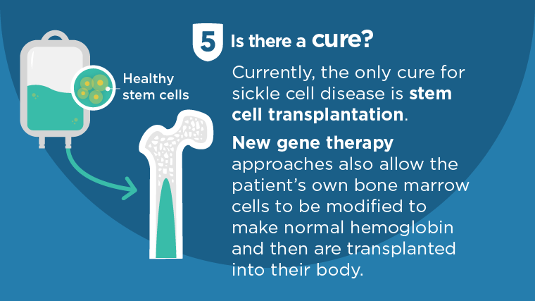 bone marrow transplant for sickle cell anemia