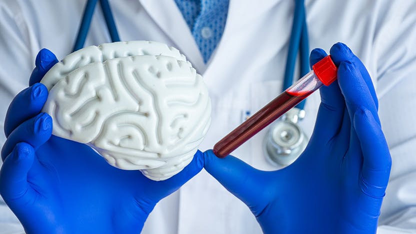 Doctor holding a model of the brain