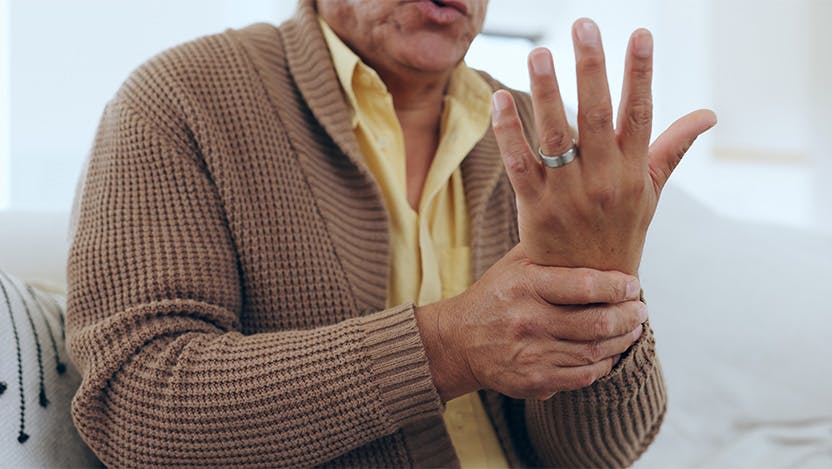 Hand arthritis stock