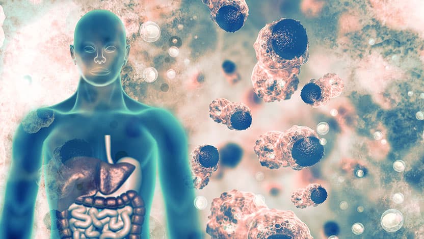 Cancer cells and human body