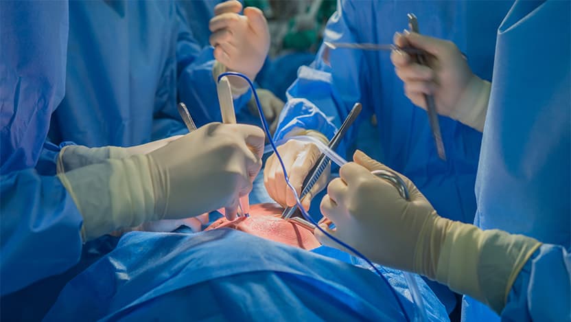 stock heart transplant