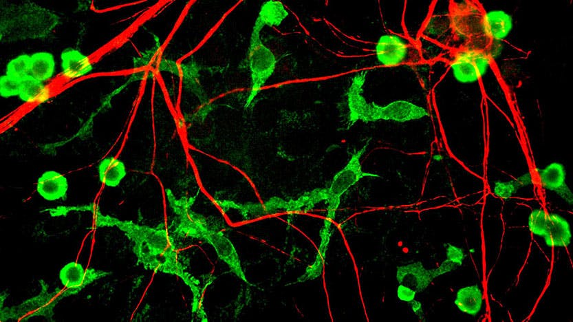 Microglia and neurons