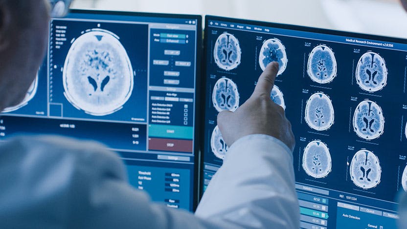 Image of pediatric neuroscientist looking at brain scan 