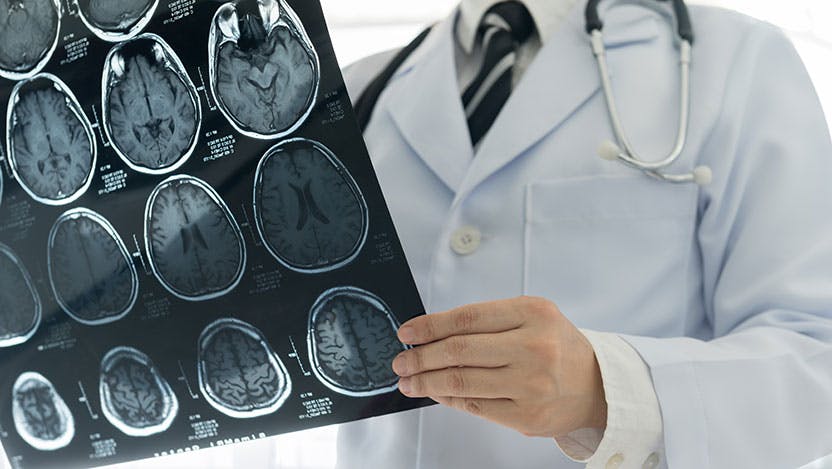 Doctor check up x-ray film of the brain by mri or ct scan brain at patient room hospital.