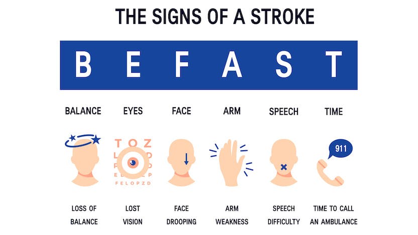Diagram of the signs of a stroke