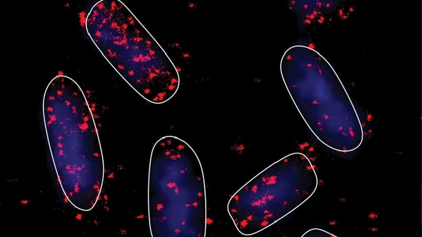 ecoli