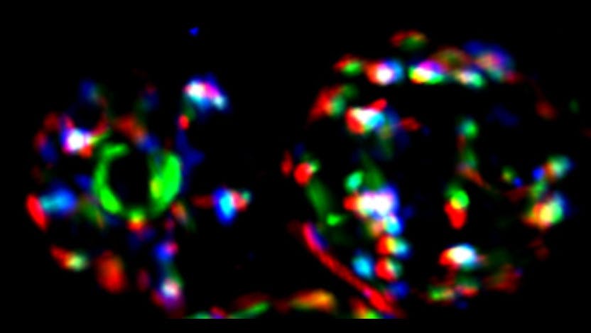 A colorized image of two cells under a microscope, with a black background and red, blue and green patterns marking proteins within the cell. In the left cell, a clear circle formed by green proteins marks where the protein Sis1 clusters after a heat shock.