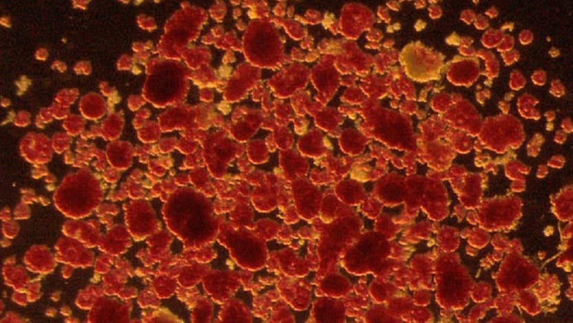 Microscopic image of pancreatic islet cells, colored orange for visibility against a black background