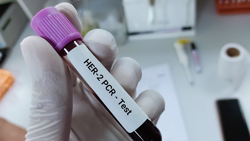 A blood vial for a breast cancer test.