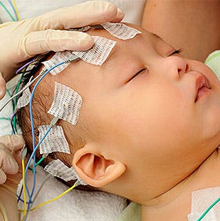 Gloved hands placing EEG electrodes on baby's head