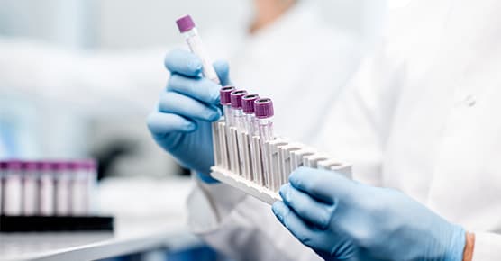 Image of celiac disease research taking place